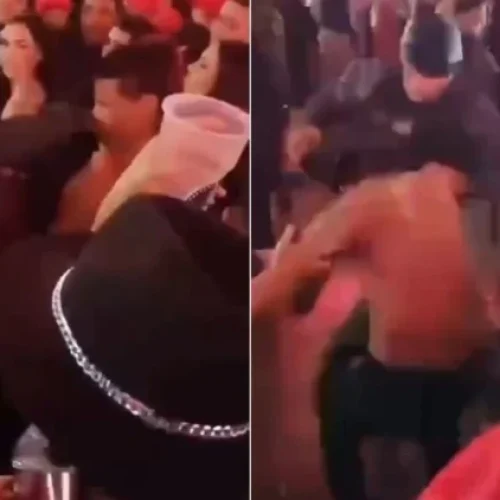 Jovem agredido por policial no São João de Campina Grande tem lesões na boca e dente quebrado: “Não deu tempo de fazer nada“