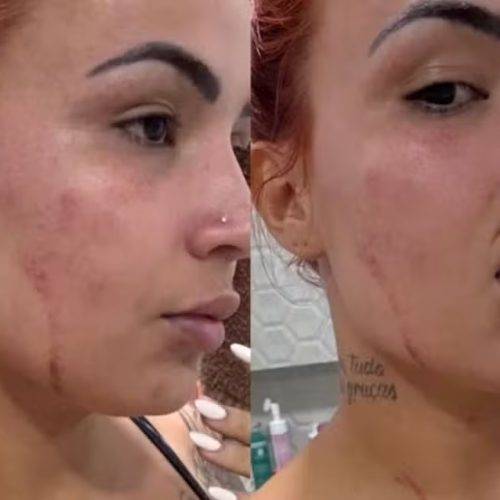 Influenciadora é vítima de perseguição e ataque a tiros, em João Pessoa